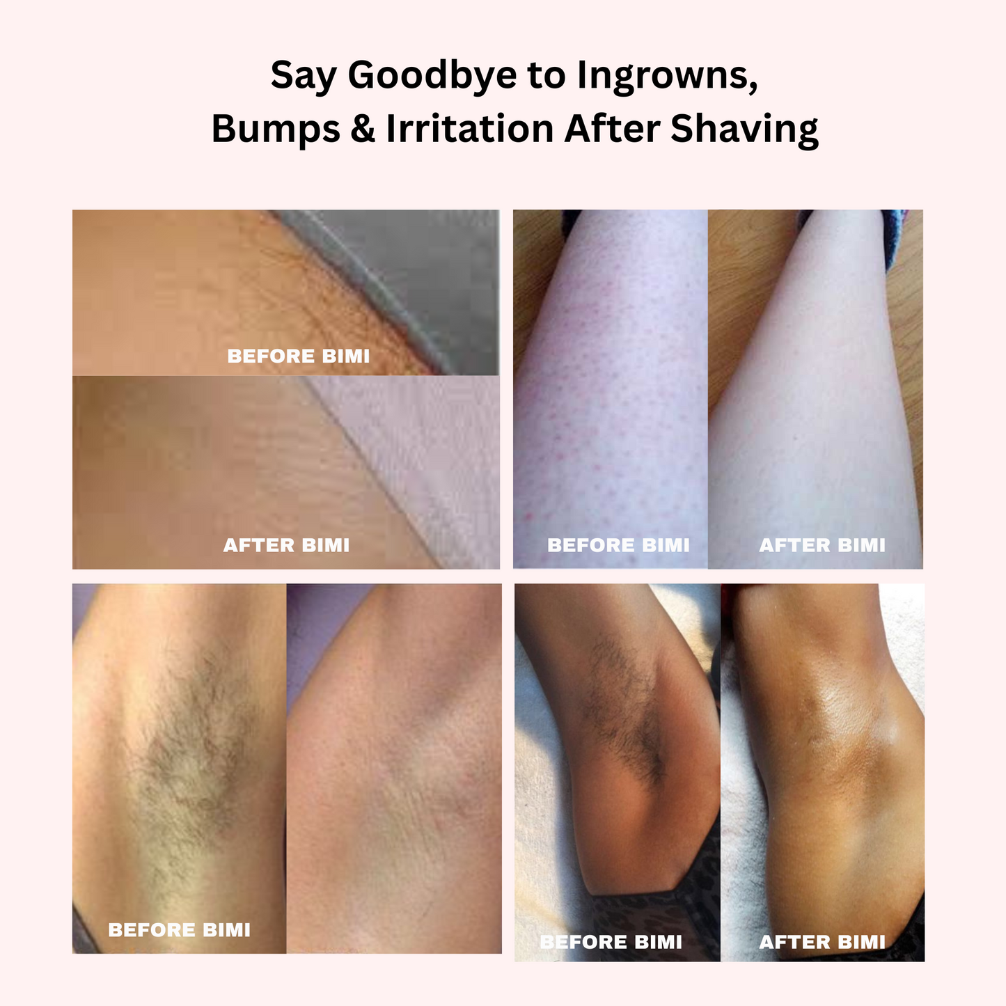 Bimi Bare Trimmer 2.0