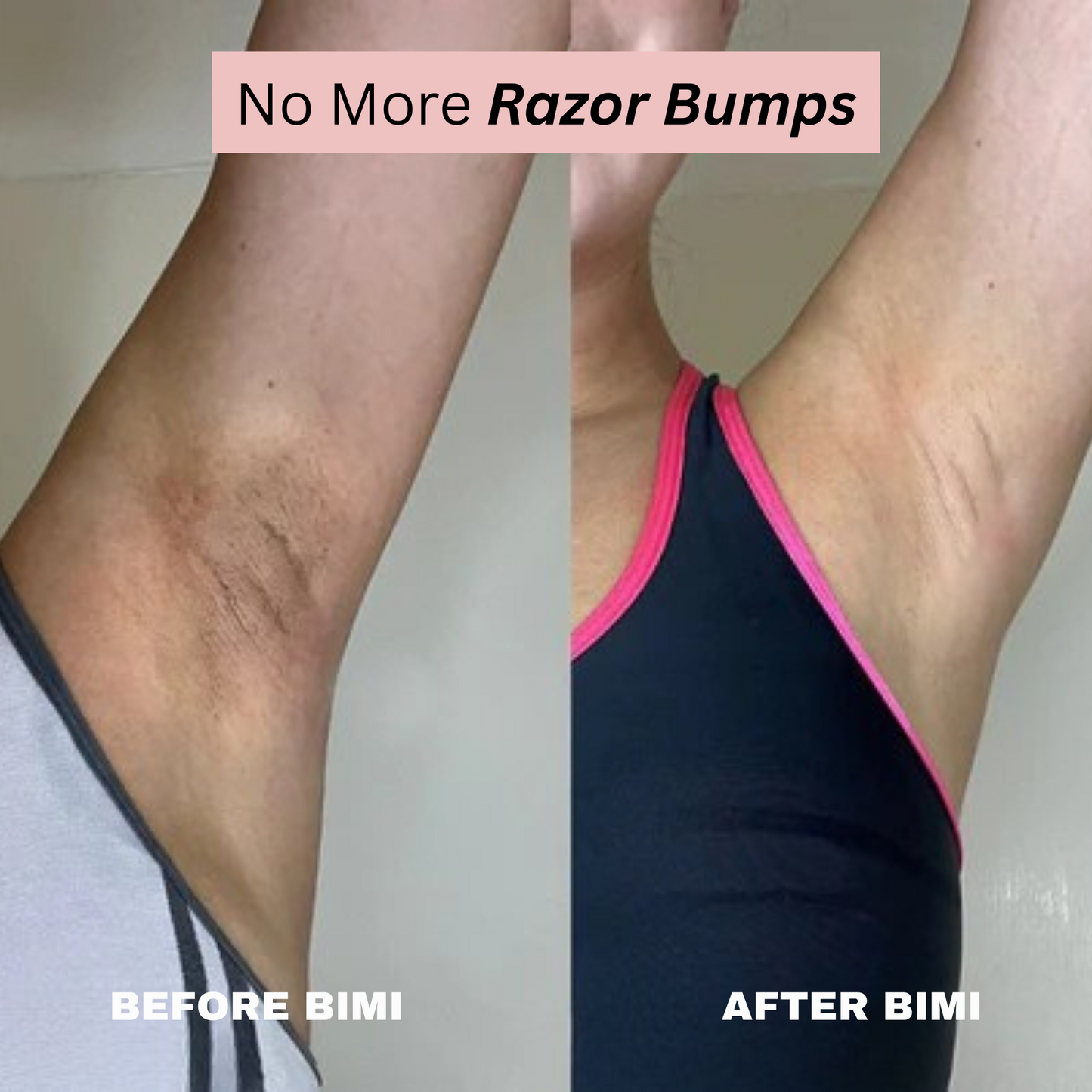 Bimi Bare Trimmer 2.0