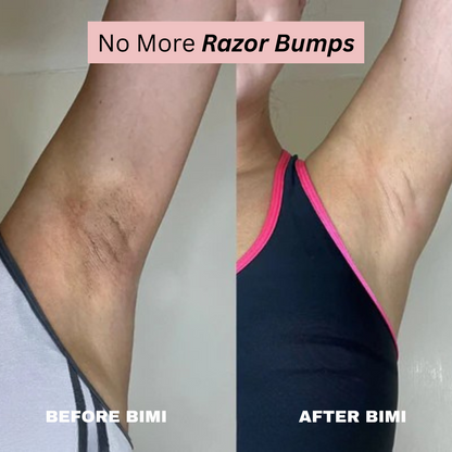 Bimi Bare Trimmer 2.0