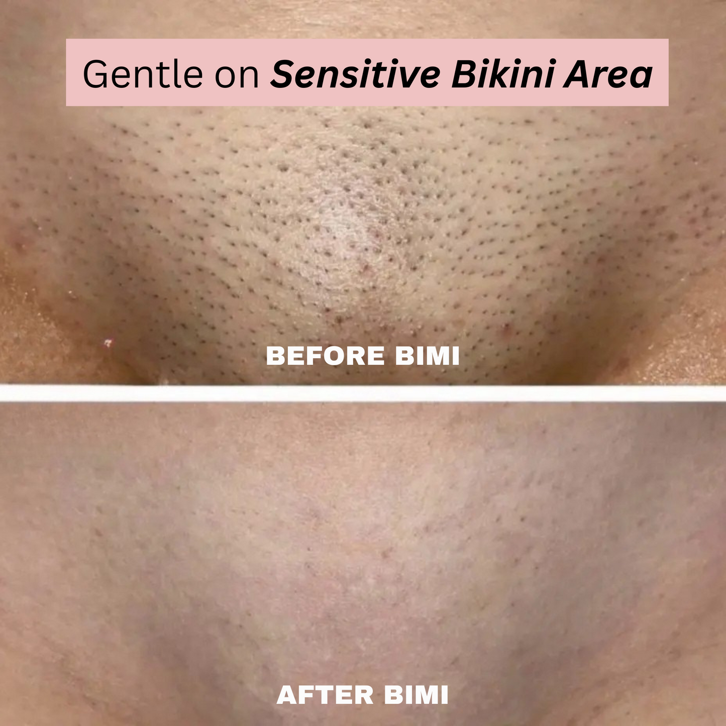 Bimi Bare Trimmer 2.0