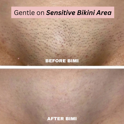 Bimi Bare Trimmer 2.0